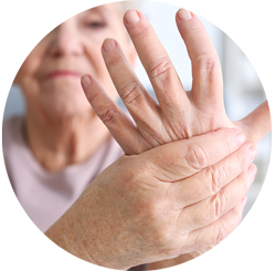 reumatoïde artritis behandelen